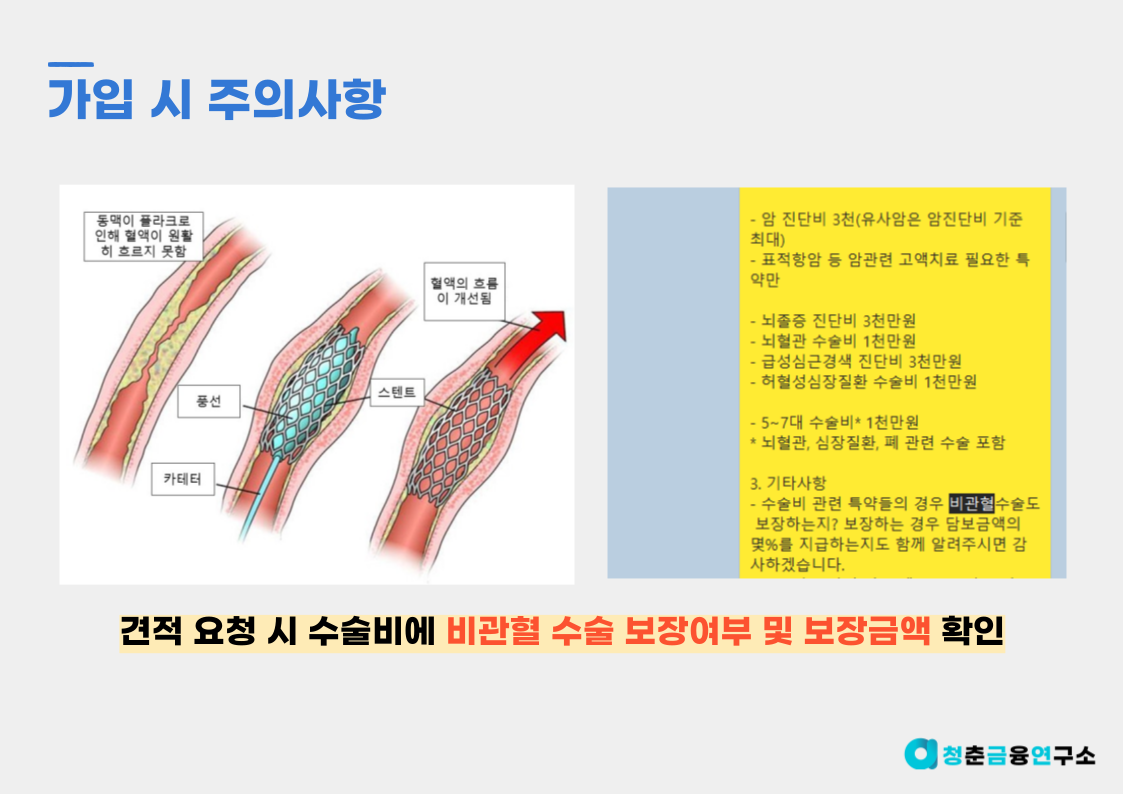 허혈성 심장질환 및 뇌혈관 질환 수술비 보험료, 주의사항, 필요성 완벽 정리