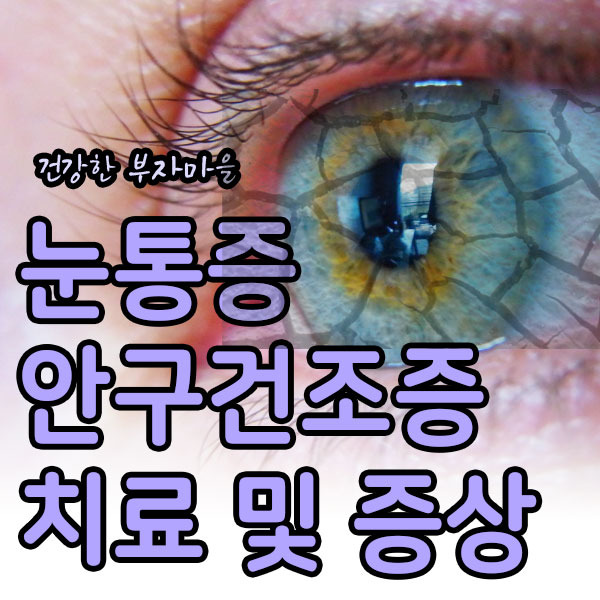 눈통증 왜? 안구 건조증 치료 및 증상