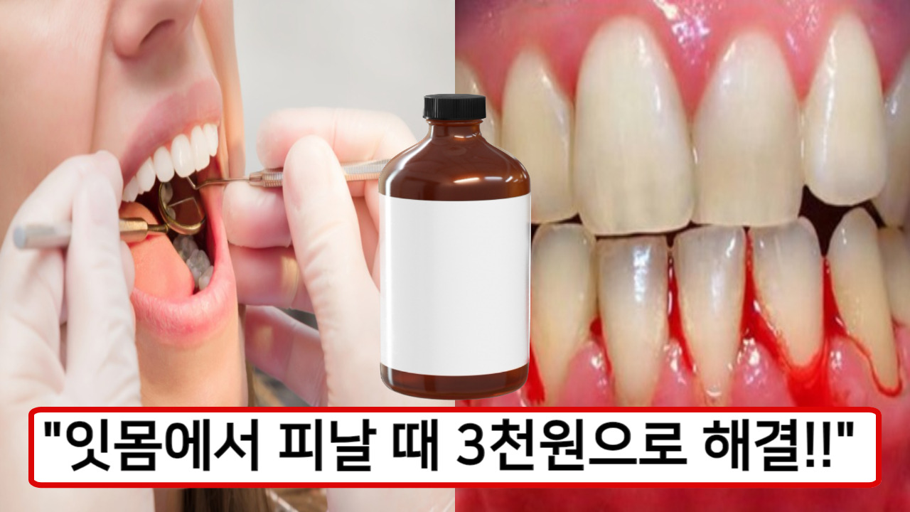 “3천 원으로!!” 집에서 잇몸에서 피날때 해결하는 방법