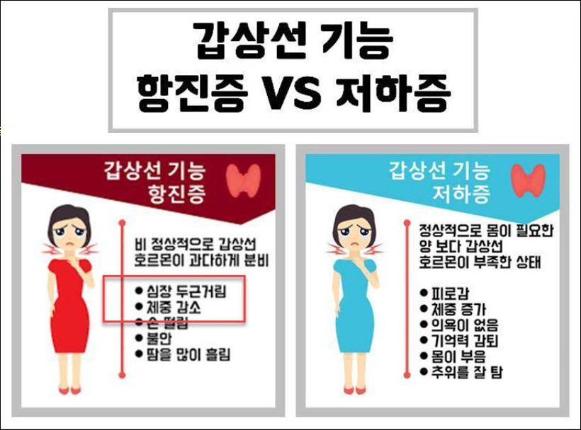 급격한 체중감소 원인 및 기준은?