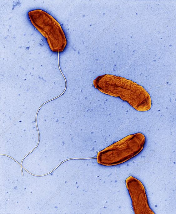 A00 콜레라(Cholera)