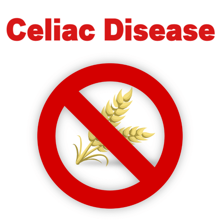 글루텐에 대한 과민 반응: 셀리악병(Celiac disease) 1 celiac disease