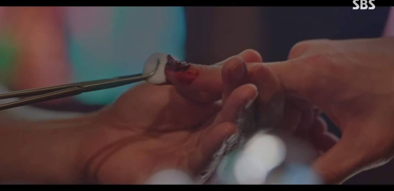 7인의 탈출 매튜 리의 정체를 밝히려면 생인손을 확인해라? : 조갑주위염이란 무엇인가? 1 ywAAAAAAQABAAACAUwAOw==
