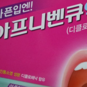 구내염(입병) 원인, 구내염(입병) 치료법, 구내염(입병) 빨리 낫는법