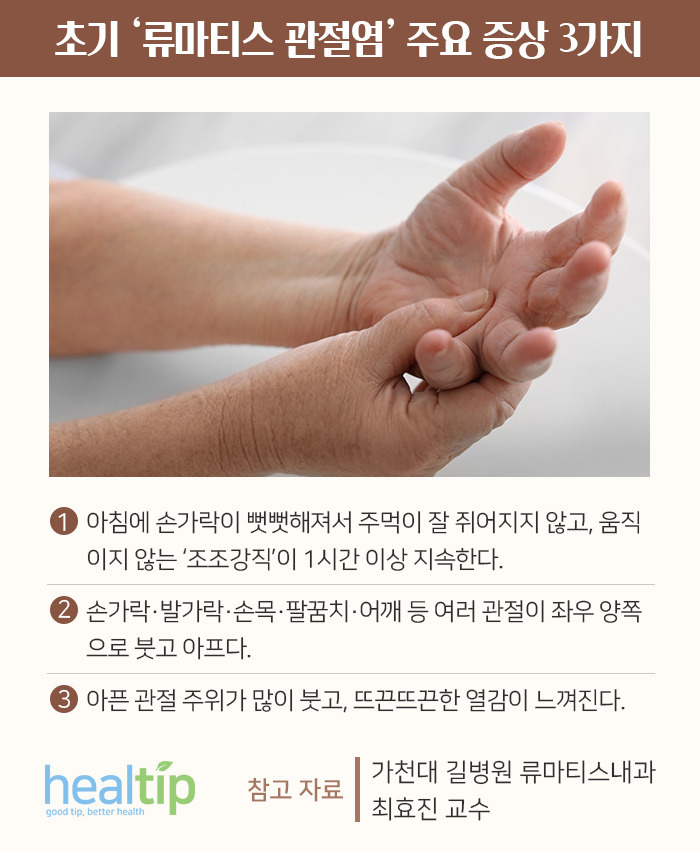 류마티스 관절염 증상 3가지