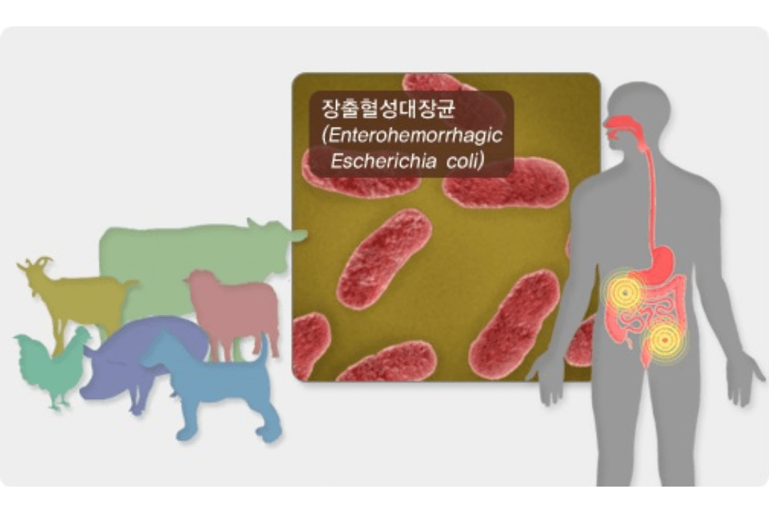 여름철 감염병: 장출혈성대장균 감염증의 이해 1 Enterohemorrhagic Escherichia coli
