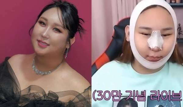 풍자 과거 사진 프로필 | 트렌스젠더 남자시절 | 성전환수술 | 나이 코수술