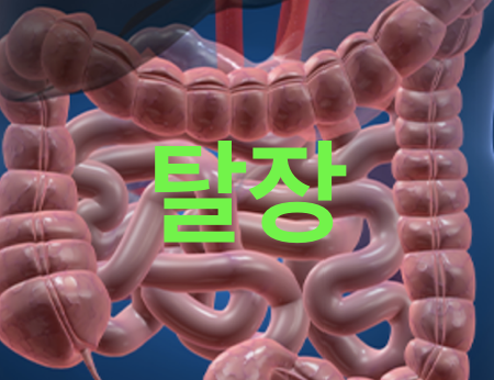 탈장 증상 수술 회복 원인 입원기간