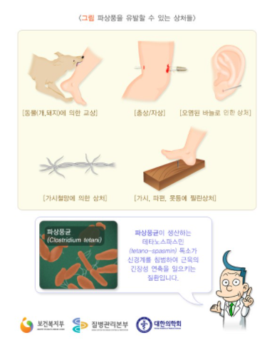 파상풍 초기증상과 3대 증상, 파상풍 주사 비용