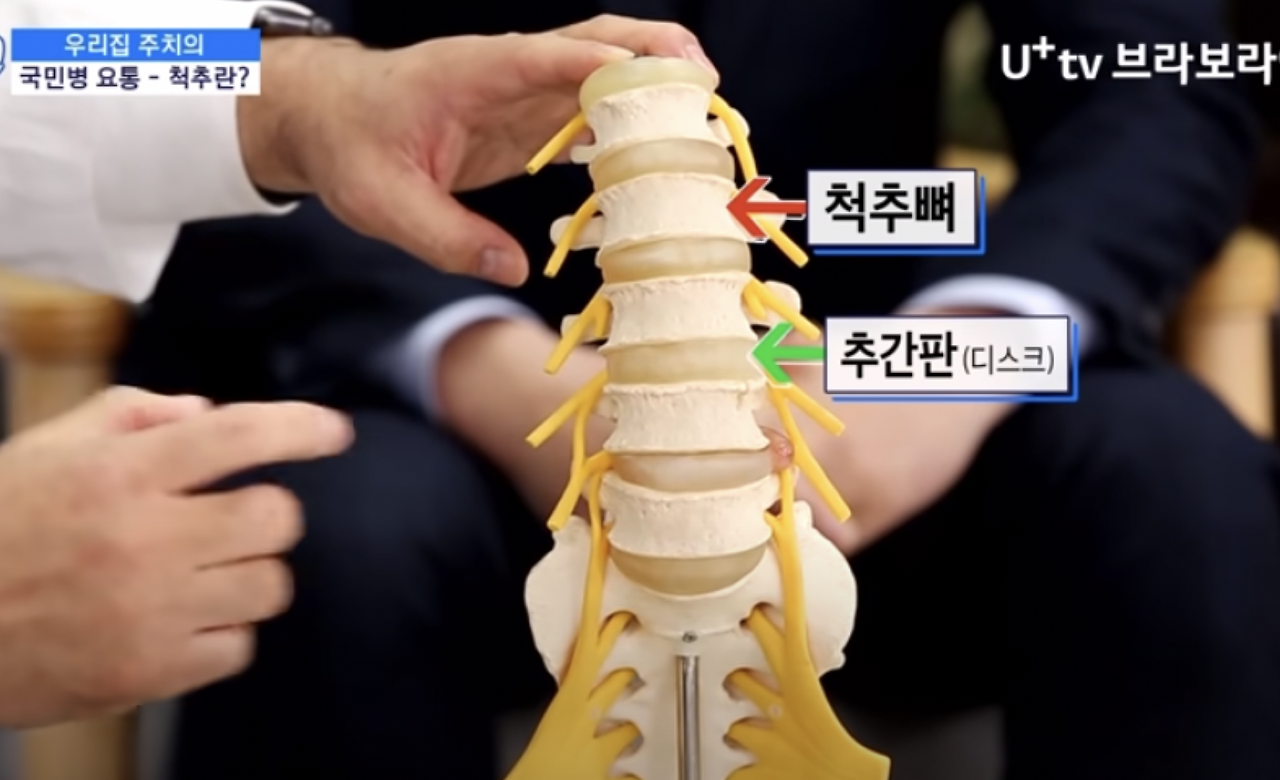 서울대 허리 명의 정선근 교수가 말하는 병원 안 가고 요통 낫는 방법