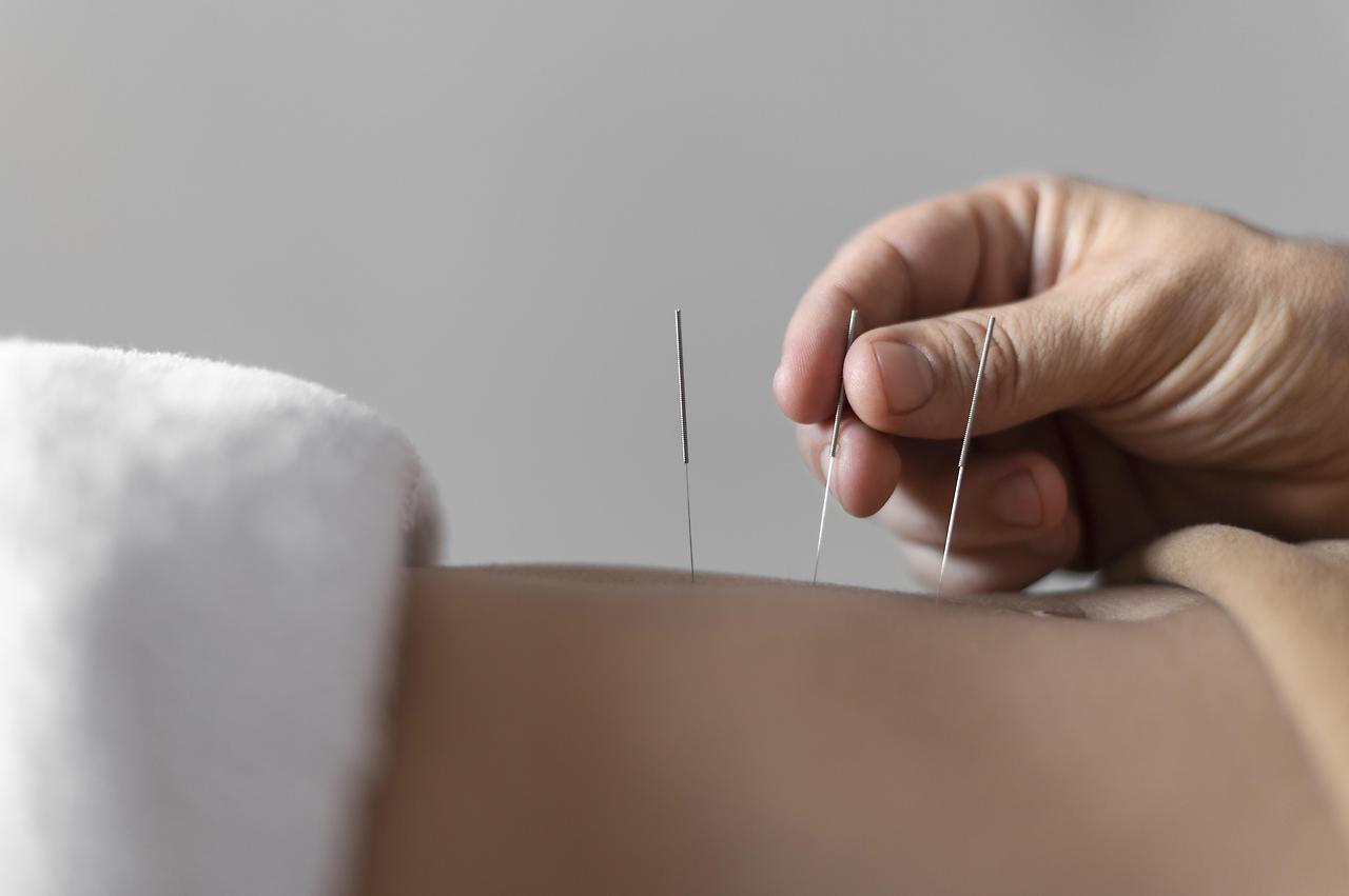 수면의 질을 혁신하는 전통 의학: 한약, 침술, 그리고 마사지 요법