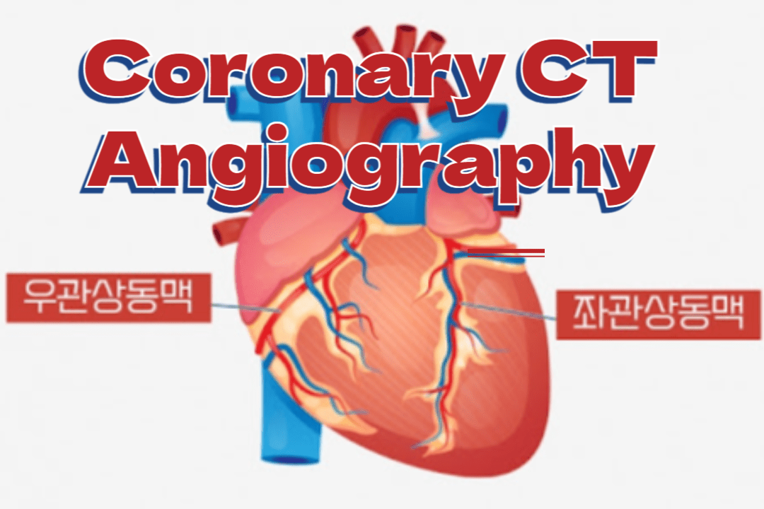 관상동맥 CT(Coronary CT Angiography, CCTA) 검사 1 Coronary CT Angiography