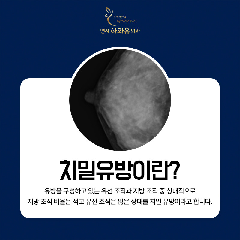 방이동유방외과 치밀유방, 유방암 걸릴 확률 높나?