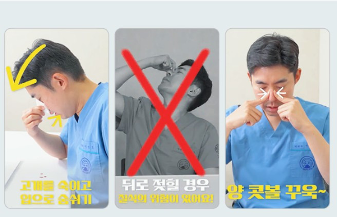 코피가 멈추지 않을때 응급처치 및 가는 병원