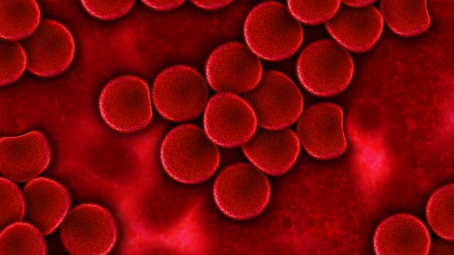 혈액암 증상 및 치료방법 & 혈액암 환자 음식, 식단 관리는 이렇게! 1 혈액암-증상-치료방법