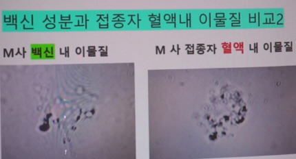 ◆ 백신성분 속의 괴물질과 접종자의 혈액 속의 이물질 모양이 비슷하다.