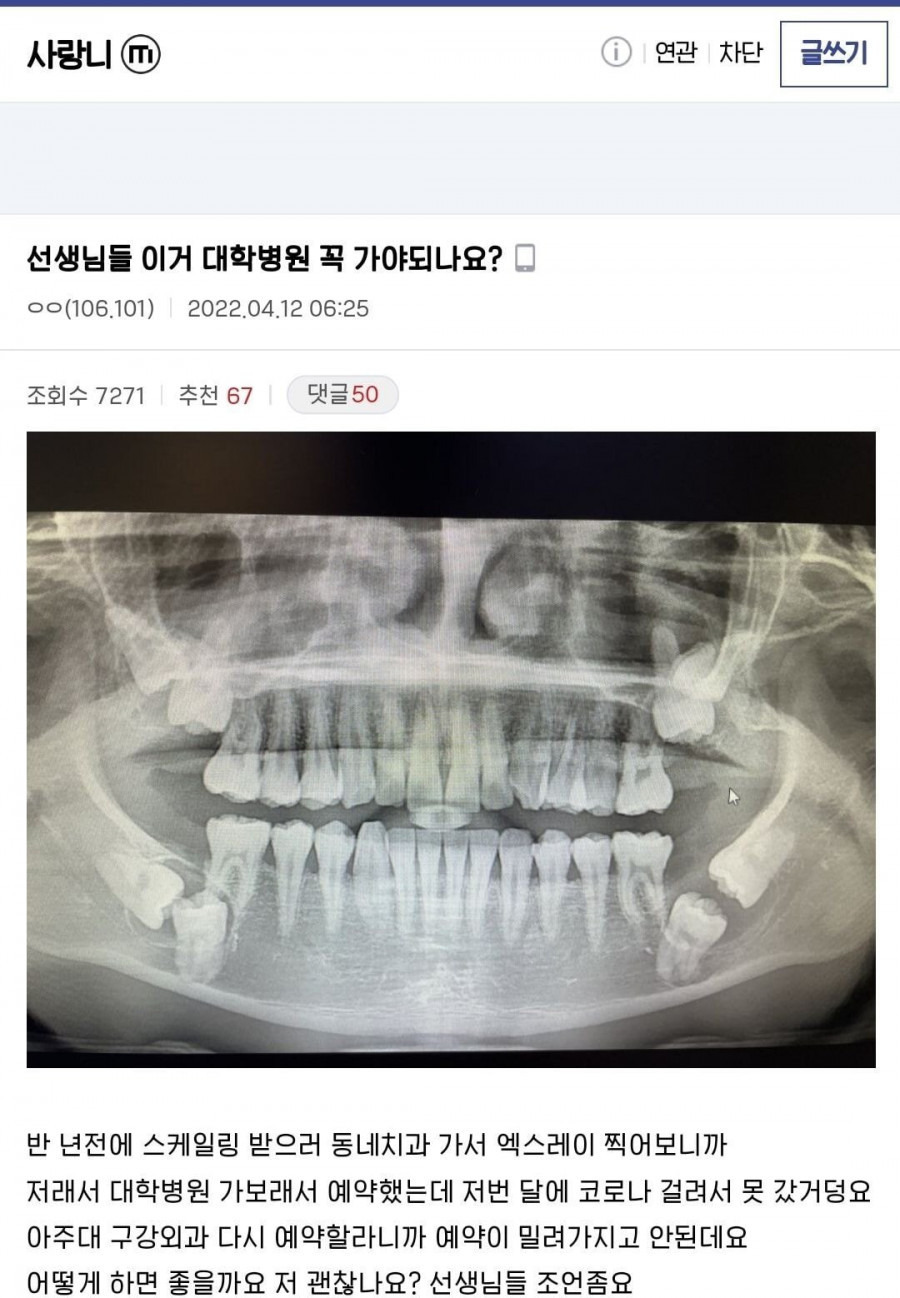 사랑니 역대급이라는 디시인 근황