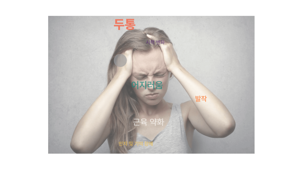 언제 터질 지 모를 머리 속 시한폭탄! : 뇌동맥류란 무엇인가? 2 ywAAAAAAQABAAACAUwAOw==