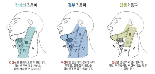 목 멍울 위치에 따른 원인과 진단 및 치료방법