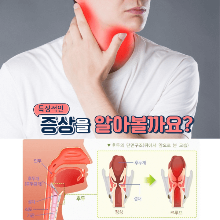 개가 짖는 것처럼 컹컹거리는 기침 : 크루프란 무엇인가? 2 ywAAAAAAQABAAACAUwAOw==