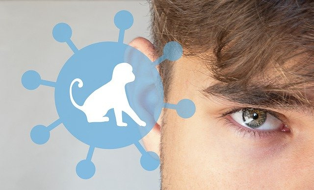 원숭이 두창이란? 그리고 원숭이 두창 증상, 감염경로, 백신 모두 알아보자! 1 원숭이 두창