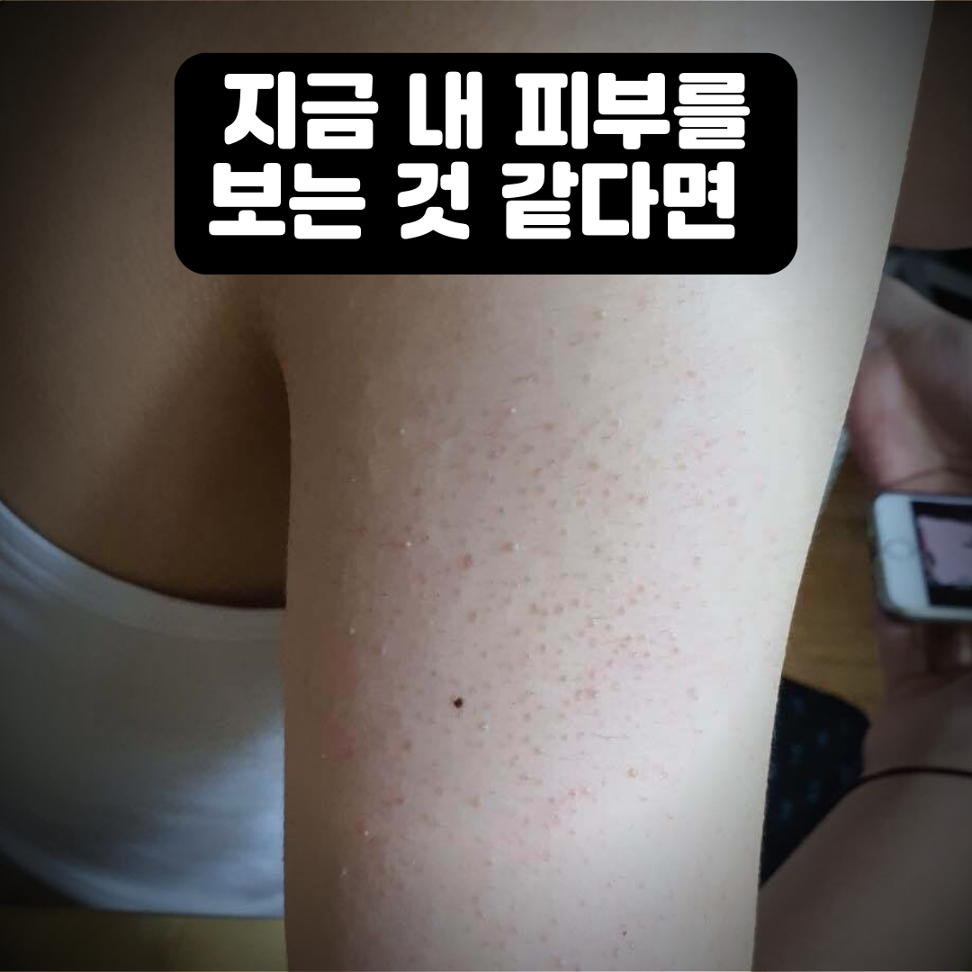 아로스 팝업
