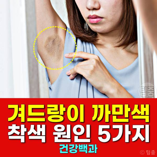 겨드랑이 까만색 착색 원인 5가지 - 겨드랑이 까만 이유