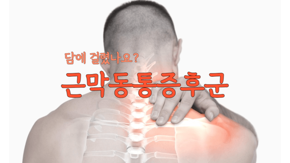 담에 걸렸어요: 근막동통 증후군(myocardial pain syndrome) 1 myocardial pain syndrome