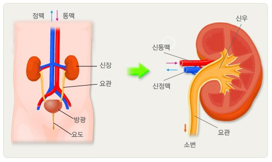 감염 부위와 단순성 여부에 따른 요로감염에 대해 1 요로감염