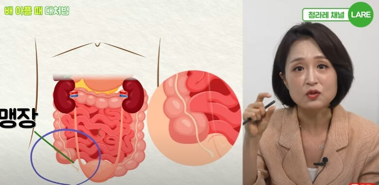 배아플때 대처법, 복부 위치에 따라 통증이 다르다.