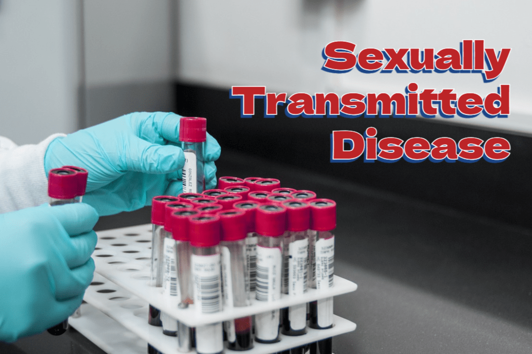 STD 검사: 항목, 방법, 결과해석 1 Sexually Transmitted Disease