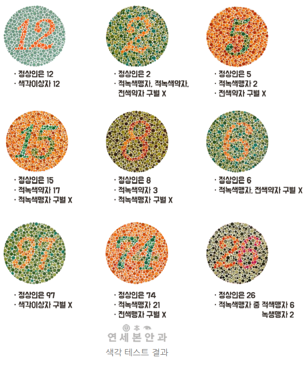 출처 _ 연세본안과 블로그