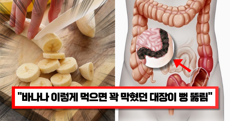 “바나나 이렇게 먹어야 효과 있다고..” 대장에 쌓인 독소를 배출해주고 장을 건강하게 만들어 준다는 바나나 레시피 1가지