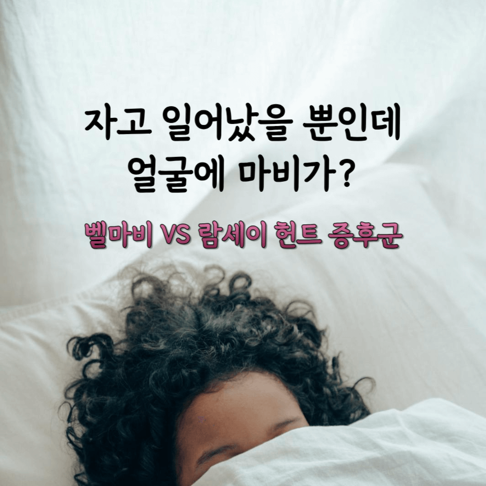 자고 일어났을 뿐인데 얼굴에 마비가? 말초성 안면 마비 VS 중추성 안면 마비 1 벨마비-람세이헌트 증후군