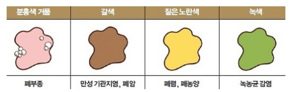 환절기에 목가래 많이 생기는 원인