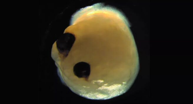 VIDEO Scientists Grew Mini Brain Grown 