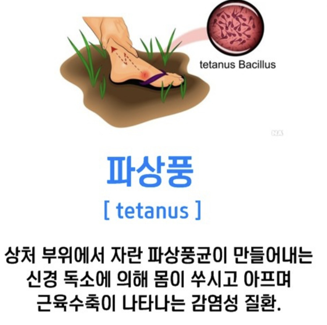 파상풍