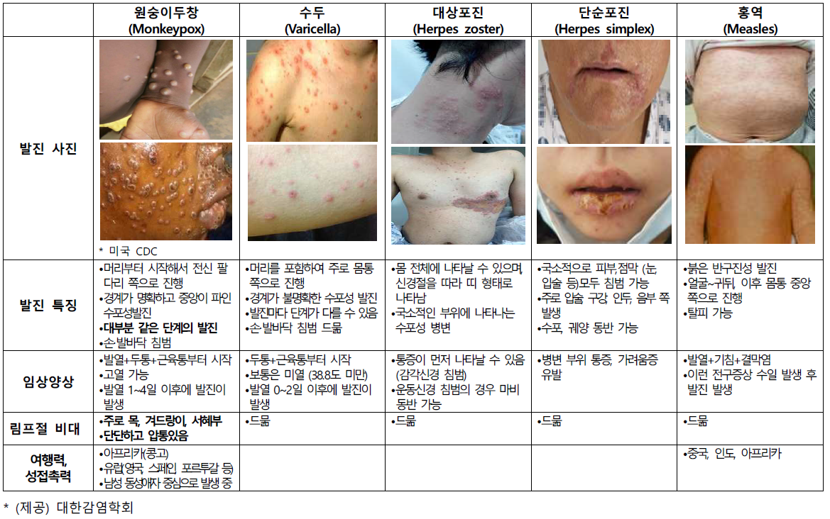 원숭이두창 관심단계 발령 (원인,증상) :: 원숭이두창 관련주 (파미셀) 2 ywAAAAAAQABAAACAUwAOw==