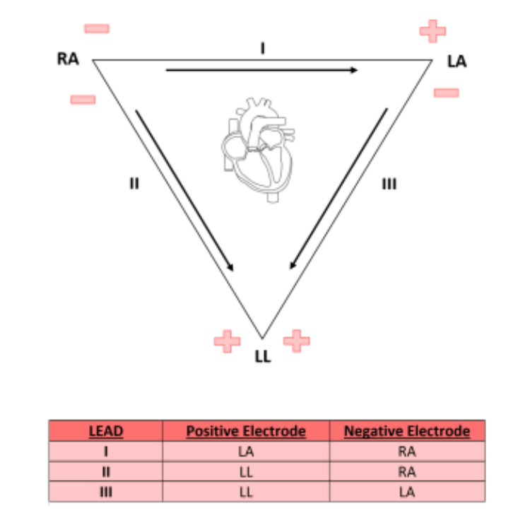  Einthoven s Triangle BioinformaticsAndMe