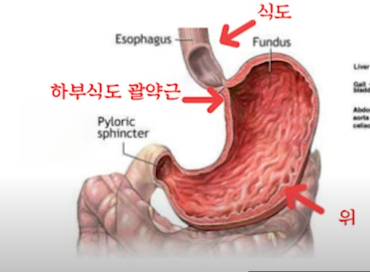역류성식도염 증상 종류 위험인자 좋은음식 나쁜음식 3 ywAAAAAAQABAAACAUwAOw==