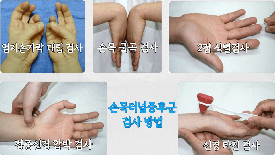 찌릿찌릿 저린 손목: 손목 터널 증후군(carpal tunnel syndrome) 3 손목터널증후군검사방법