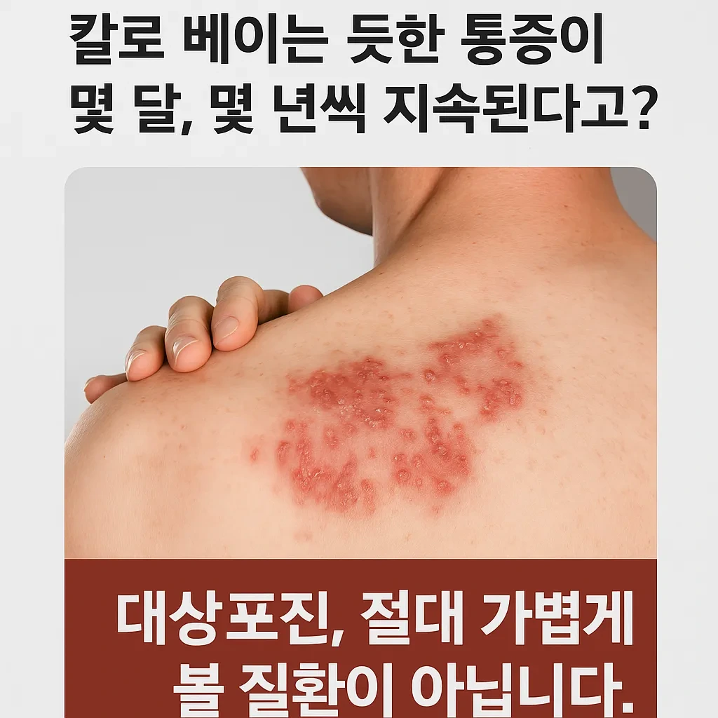 대상포진 예방접종 정보를 한눈에 정리한 한국어 인포그래픽 이미지. 백신 종류, 접종 대상, 효과, 주의사항 등을 시각적으로 표현함.
