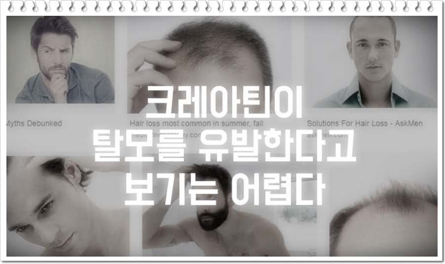 시스토리 :: 크레아틴 탈모 부작용