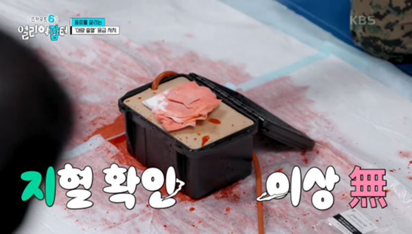 처음 보는 사람은 다소 충격적이라는 대량 출혈 부상자 지혈하는 방법 | 인스티즈