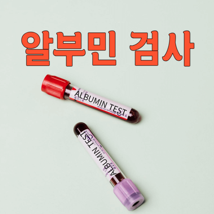 간과 신장 건강의 지표: 알부민 검사 1 알부민 검사