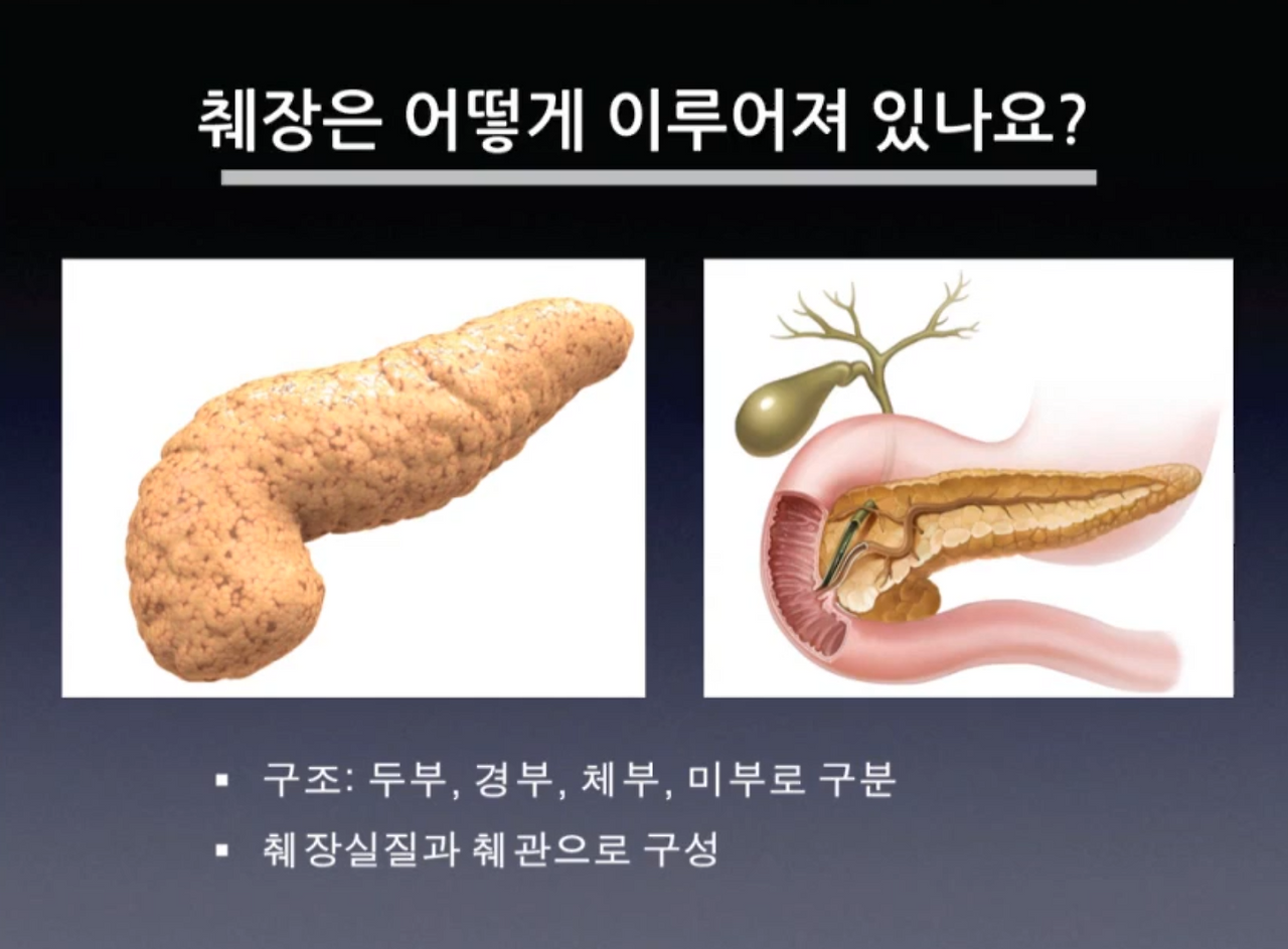 췌장암 초기증상