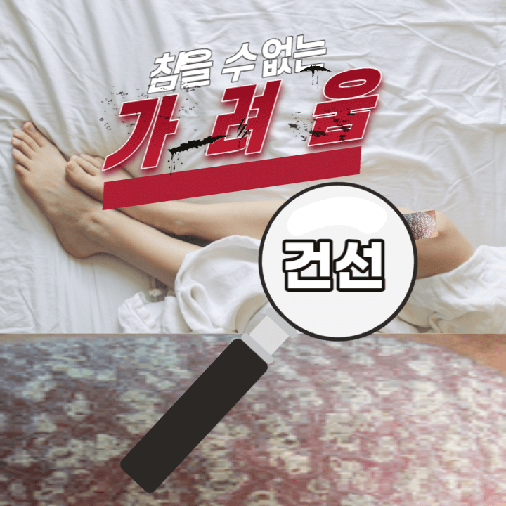 가려움과 각질에 스트레스. 건선이란 무엇인가? 1 ywAAAAAAQABAAACAUwAOw==