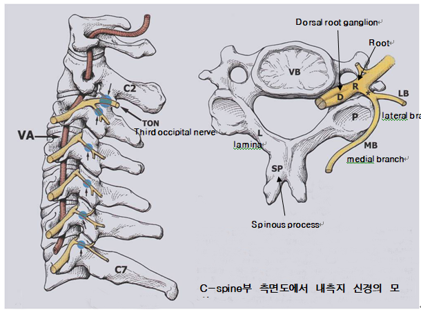 1) T-spine MBB(T-spine medial 지 블록 )