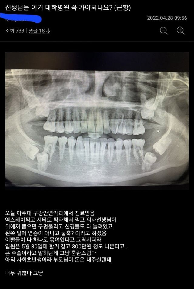 ?scode=mtistory2&fname=https%3A%2F%2Fblog.kakaocdn.net%2Fdn%2Fr6art%2FbtrBuy7CRab%2FtM2iKKQJxt9qsvnTJQIek0%2Fimg.jpg