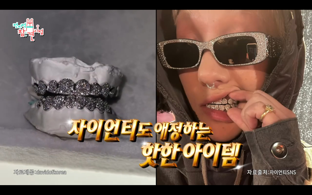 [전참시] 자이언트 애착 패션템 그릴즈(Grillz)